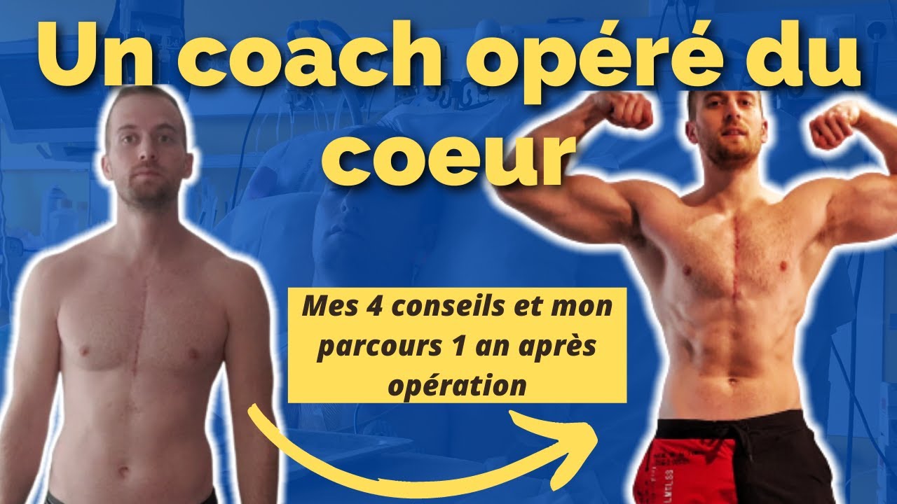 TRANSFORMATION PHYSIQUE APRÈS UNE OPÉRATION À COEUR OUVERT (mon parcours sur 1 an)